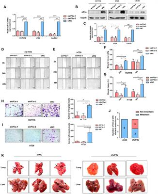 eIF3a Regulates Colorectal Cancer Metastasis via Translational Activation of RhoA and Cdc42